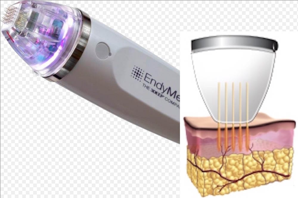 Intensif RF Microneedle Union Square Laser Dermatology, New York
