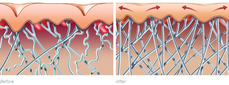 BTL-Protege_picture_colagens-B&A