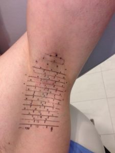 miraDry procedure preparation