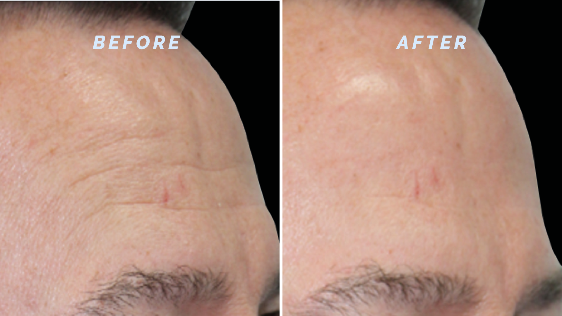 Emface Near Me Unlocking Facial Recognition Technology